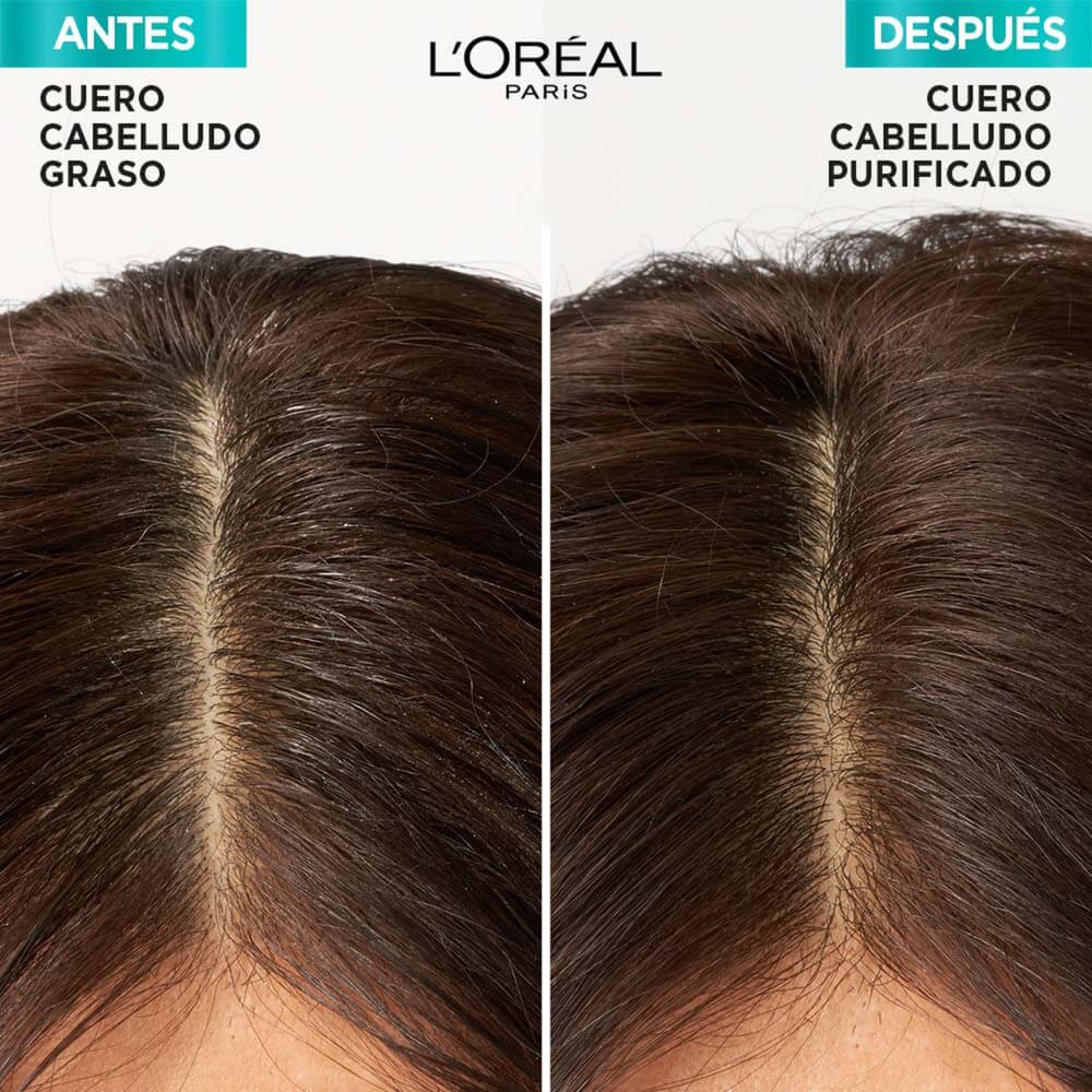 elvive hialuronico pure de L’Oreal Paris antes y despues